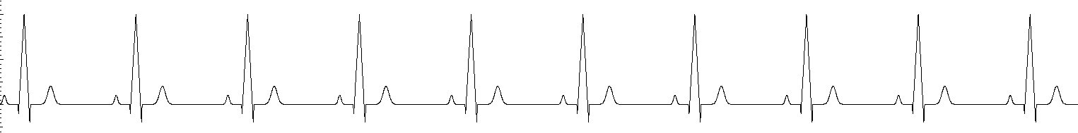 Generated ECG